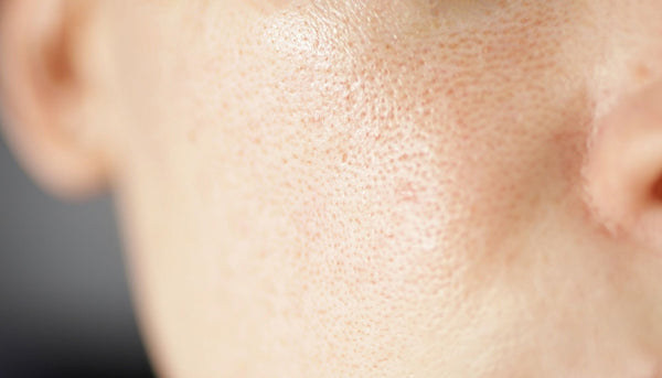 20 Japanese Skincare Products That Will Get Rid Of Your Clogged Pores